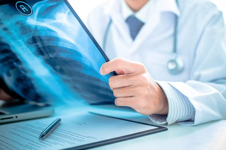 Spinal Cord Injury Attorney Hi Vista thumbnail
