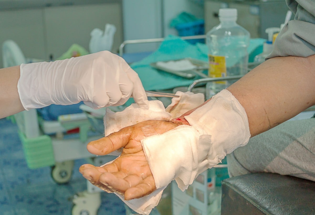 exploring-the-costs-of-severe-burn-injuries-merkel-cocke-p-a