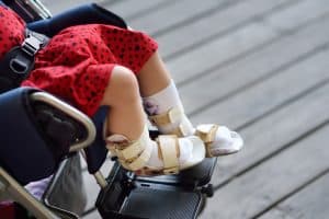 How Cerebral Palsy Affects Lives into Adulthood